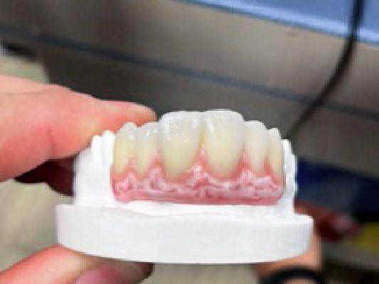 estratificacion-encia-rosa